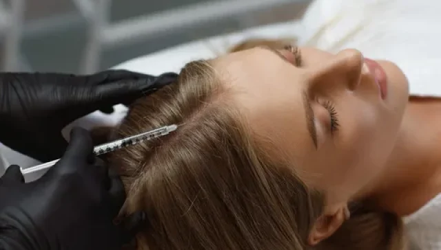 Saç Mezoterapisi